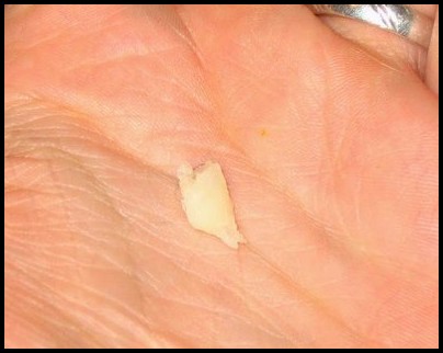 Bouchon smegma rat mâle